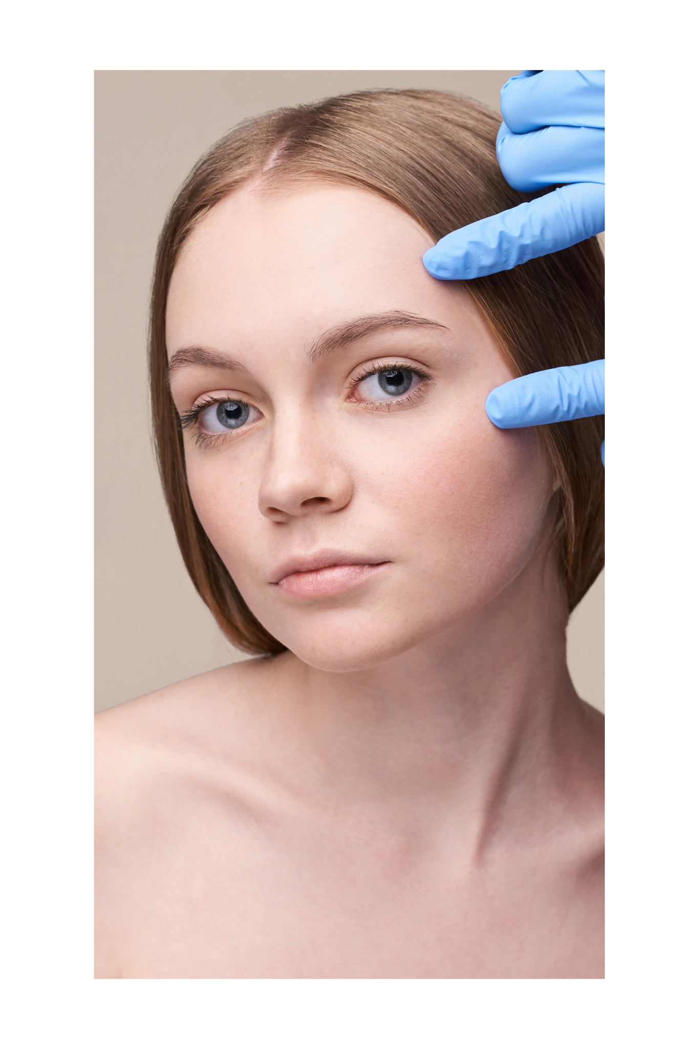 Blepharoplasty